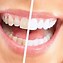 Image result for Blanchiment Des Dents