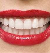 Image result for Clean Teeth with Water