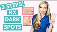 Fix Your Dark Spots in 3 Steps! | Hyperpigmentation | Melasma | Skincare Made Simple