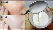Add Just 1 Thing With Rice flour Cream And Get Full Fairness | Instant Skin Whitening Face Pack