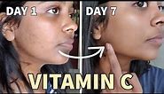 I tried Vitamin C serum for ONE WEEK! 😱 BEST Vitamin C serum for face?