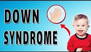 Down Syndrome Features