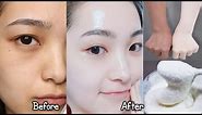 Japanese secret to whitening skin and get rid of pigmentation to get a fresh complexion