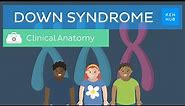 Down Syndrome: Definition, causes, symptoms, diagnosis | Kenhub