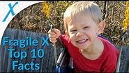 Fragile X Syndrome (FXS) 10 Things You Did Not Know
