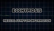 Ecchymosis (Medical Symptom)
