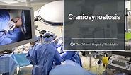 What Is Craniosynostosis? (6 of 9)