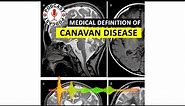 Canavan disease. Medical Definition of Canavan disease. Podcast