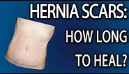 Hernia Scar Tissue: How Long To Heal?