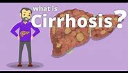 Cirrhosis - What is cirrhosis?