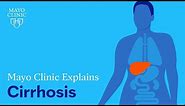 Mayo Clinic Explains Cirrhosis
