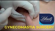 Gynecomastia Surgery Post Op Care: Kenalog-10 Shot