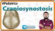 Craniosynosostosis : Types, Causes, Diagnosis and Treatment : Pediatrics National exit test