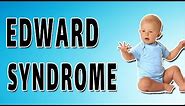 Edward Syndrome: Shining a Light on a Rare Condition