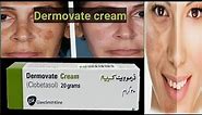 Dermovate Cream Review || Uses || Dermovate cream for skin whitening.