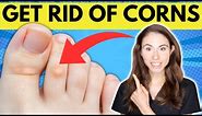 How To Get Rid Of Corns On The Feet