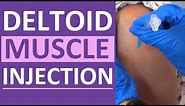 Intramuscular Injection in Deltoid Muscle with Z-Track Technique