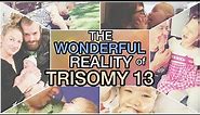 The Wonderful Reality of Having a Trisomy Child || Trisomy 13 / Patau Syndrome (13トリソミー)
