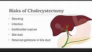 What is Laparoscopic Cholecystectomy?