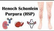 Henoch Schoenlein Purpura (HSP) - Causes, Pathophysiology, Diagnosis, And Treatment