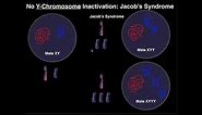 Jacob's Syndrome | A Y-Chromosome Aneuploidy