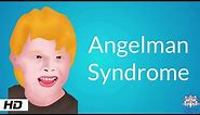 Angelman Syndrome, Causes, Signs and Symptoms, Diagnosis and Treatment.