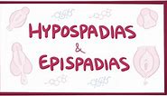 Hypospadias and epispadias: Video, Anatomy & Definition | Osmosis
