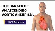 Surgeon describes an ascending aortic aneurysm | UW Medicine