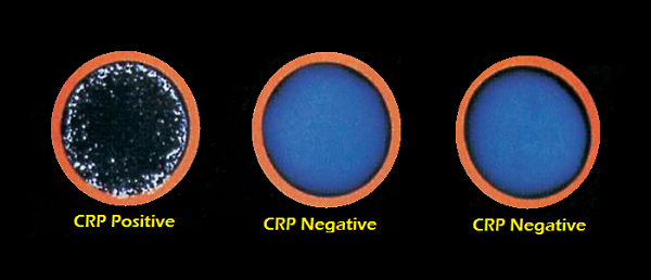 What is CRP (C-Reactive Protein) test?