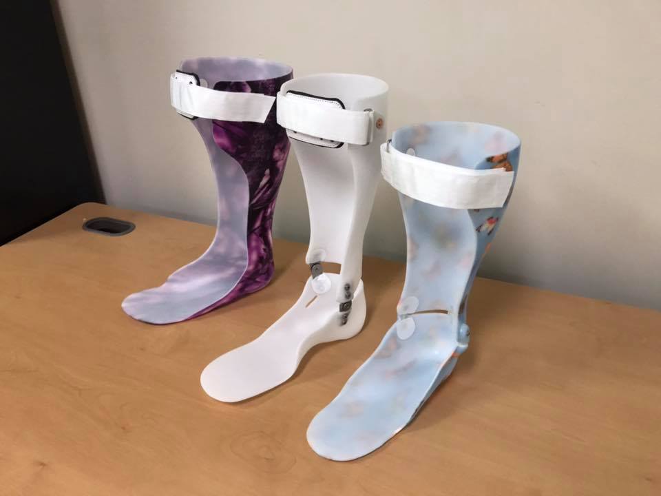 Custom Made AFOs Effective in Fall Prevention - Green Prosthetics and ...