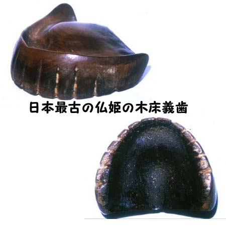 日本最古の入れ歯: 井上歯科「医院ブログ」