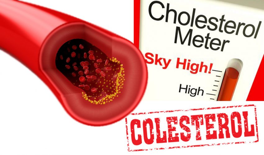 obat kolestrol