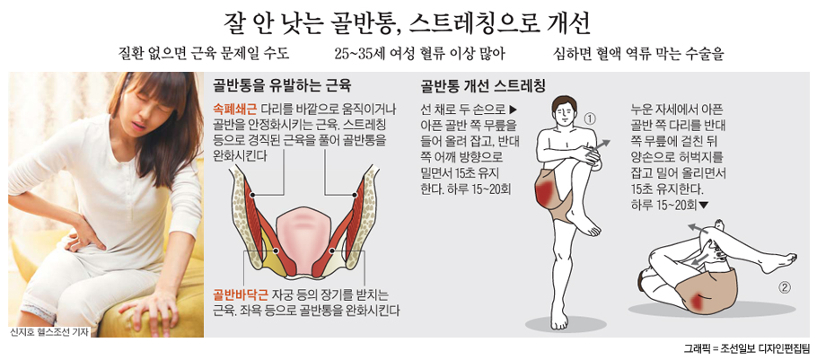 원인 모르는 만성 골반통 상당수는 골반 근육 경직때문 - 조선닷컴 인포그래픽스 - 그래픽 뉴스 > 라이프
