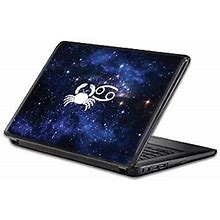 Universal 13" Laptop Skin - Cancer | Protective, Durable, And Unique