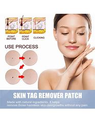 Image result for Vinegar to Remove Skin Tags