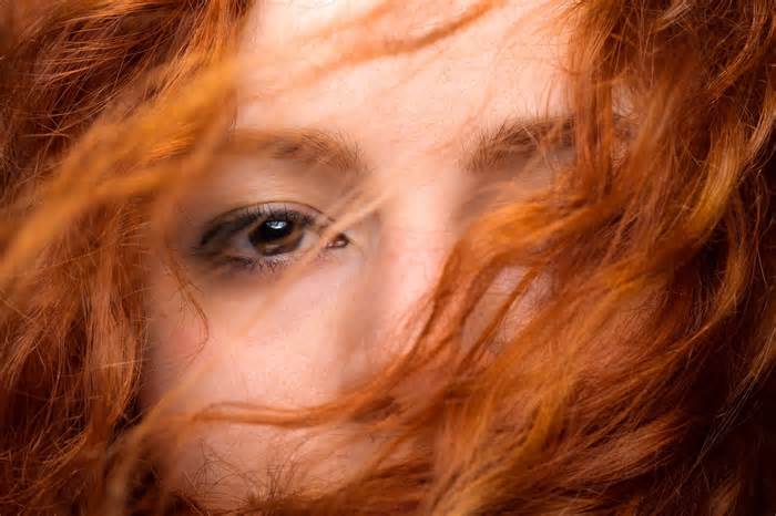 How rare are redheads?