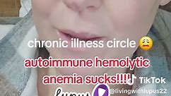 #lupus #lupusawareness #fibromyalgia #anemic #autoimmunehemolyticanemia #autoimmunewarrior #chronicillness #chronicpain #advocateforyourself #bonepain