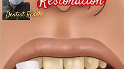 Dental cavity filling | restoration animation | composite filling #viral #youtubeshorts #dentist