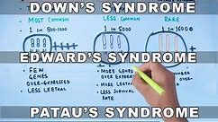Trisomy | Down's vs Edward's vs Patau's Syndrome