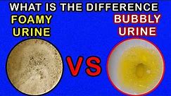 Differences between Foamy Urine Vs Bubbly Urine