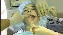 General Procedures in Oral Surgery