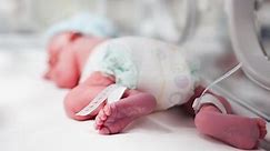 Caesarean births linked to developmental delays in children