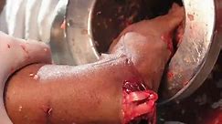 Painful Kitchen Accident - Extreme Hand vs. Meat Grinder Self Pwn