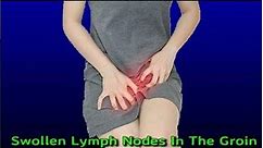 Swollen Lymph Nodes In The Groin #shorts #healthyshorts
