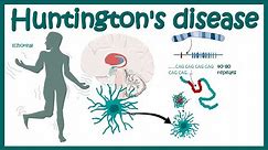 Huntington's Disease | Pathology of Huntington's Chorea | Diagnosis of Huntington's disease