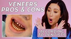 The Cost of Dental Veneers: Cosmetic Dentists Share Pros & Cons | Beauty With Susan Yara