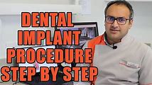 Learn How to Get a Dental Implant in Six Videos