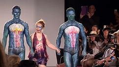 Down teen and bionic model walk at NY fashion week