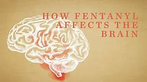 Fentanyl: How a Powerful Drug Affects Your Brain and Body
