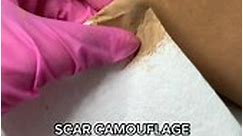 Learn More about Scar Camouflage with Our Paramedical Micropigmentation Training❗ Be the first in your City! BONUS COURSES: Inkless Stretchmarks Revision and Pinkish Areola 🎀 Paramedical Micropigmentation Training SCARS 🔵 VITILIGO 🔵 STRETCHMARKS 🔵 AREOLA 📍Waze/Google Map: The Glow Up Beauty Lounge Sampaloc, in front of The University of Manila 📞 0917-759-7068 📩 theglowupbeautycenter@gmail.com 📩campion.skinatelier@gmail.com #fyp #training #micropigmentacion | Skin Atelier